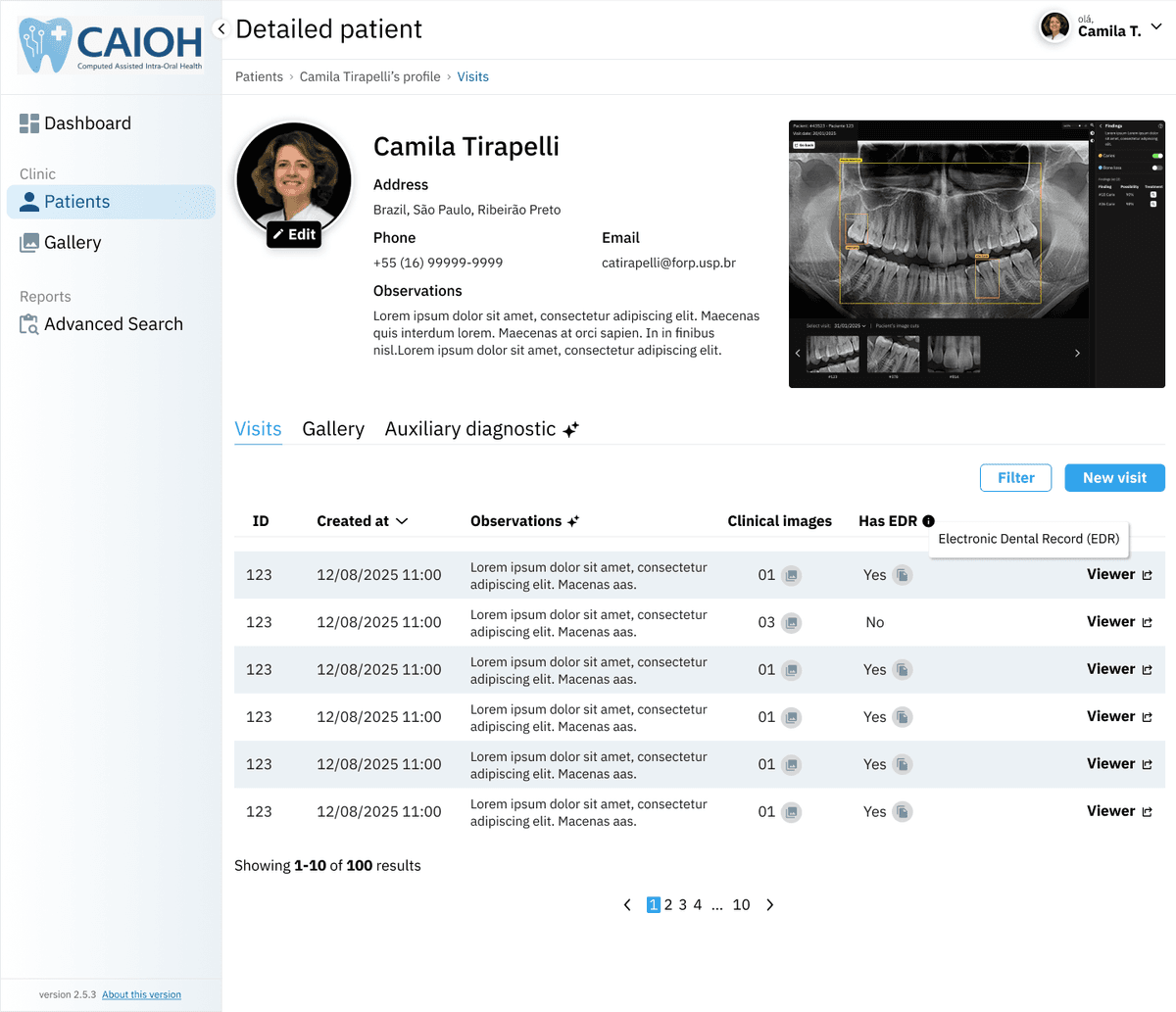 CAIOH Interface Screenshot